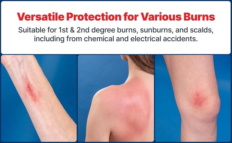 BURNFIX ® Hydrogel Burn Spray – 2 Pack (120ml Each) | Fast Cooling Relief for 1st & 2nd Degree Burns, Sunburns & Scalds | Doctor Recommended, Soothes & Hydrates Skin | Safe for Kids & Adults (2) - Image 4